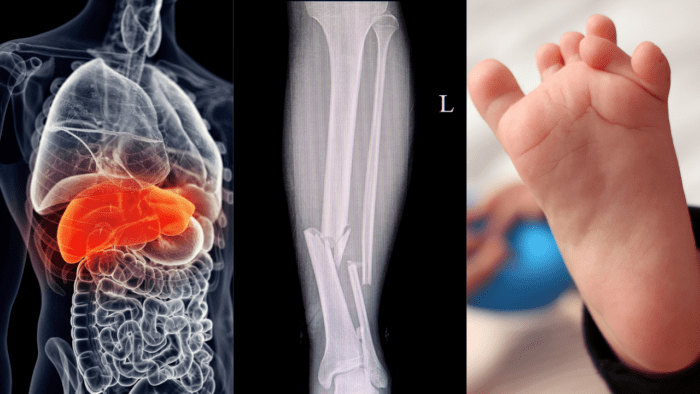 This image collage represents various root causes of health issues. The highlighted liver underscores the importance of organ health, the X-ray showcases the impact of physical injuries like fractures, and the baby’s foot symbolizes developmental stages and conditions. Together, these images emphasize a comprehensive approach to understanding and addressing health challenges.