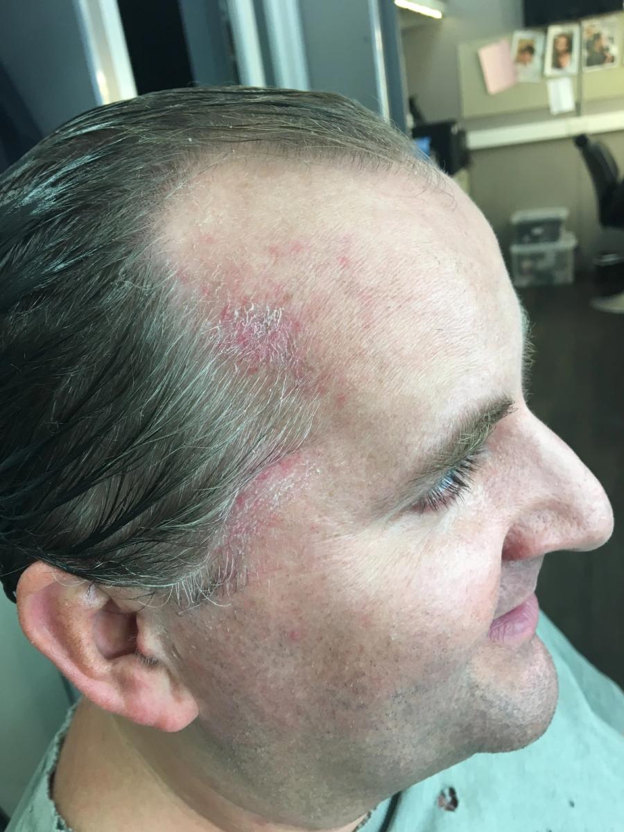 Baptiste - Behind the scenes 3