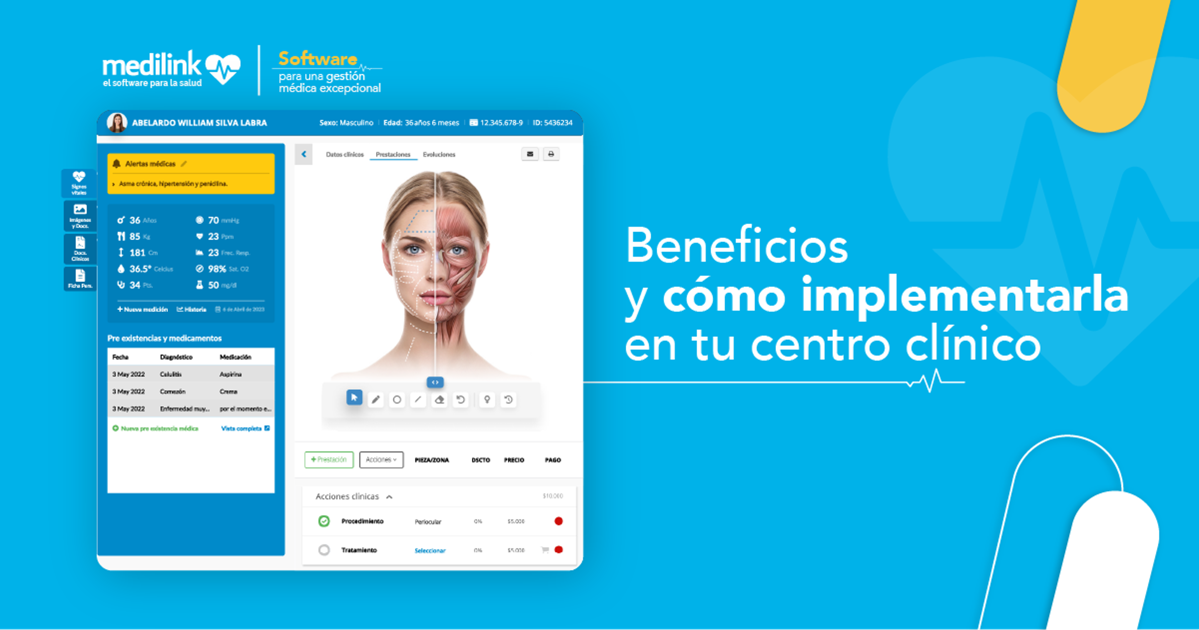 ¿Por qué tener una ficha estética facial en línea?
