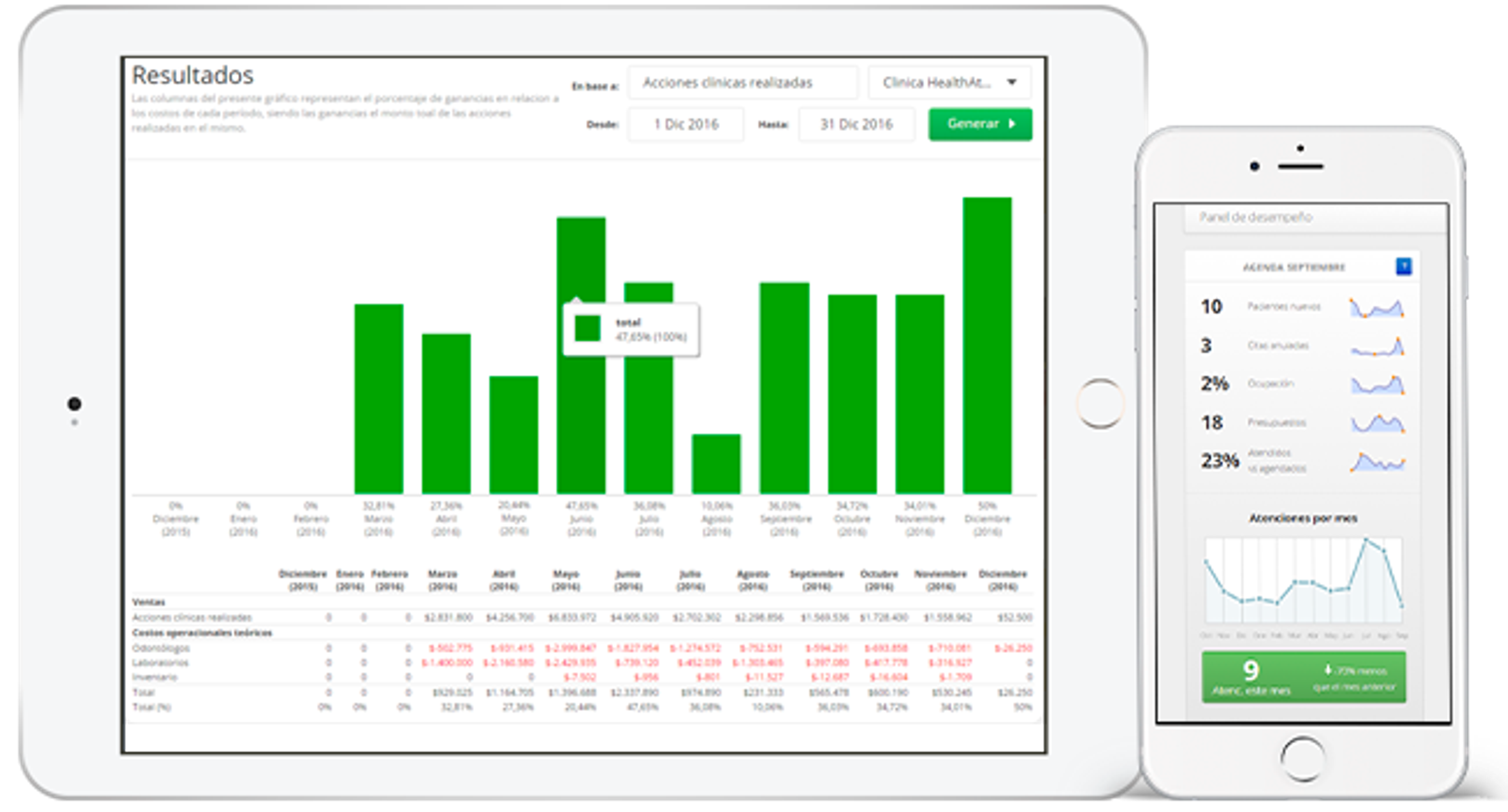 Reportes de Gestión | Software Dentalink
