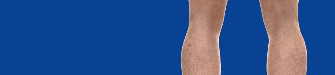 hematocrit testosterone biomarker