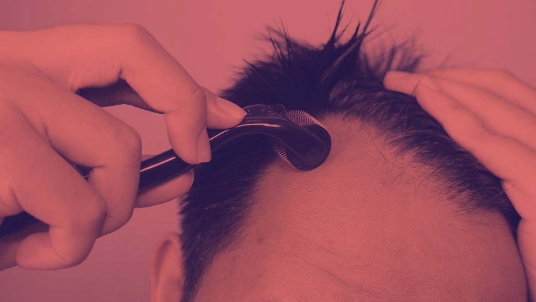 man losing hair
