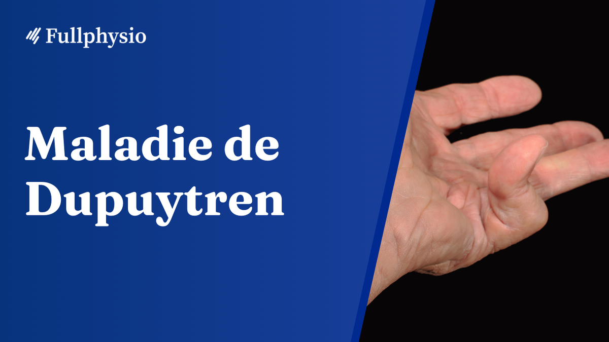 Maladie de Dupuytren