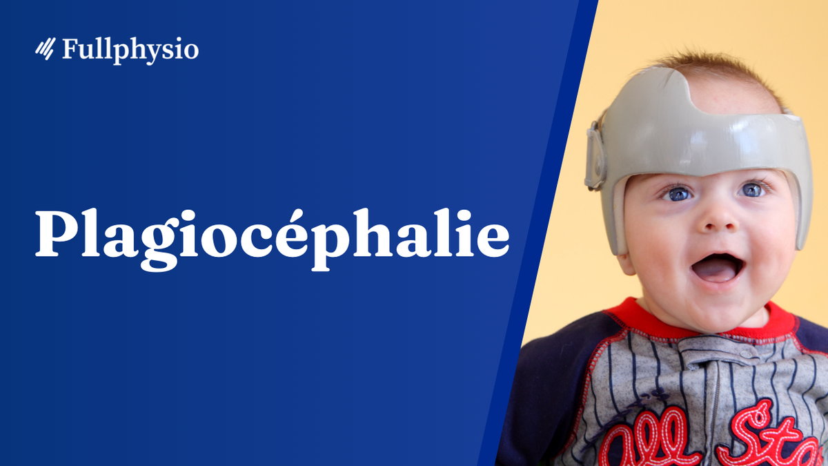 Plagiocéphalie