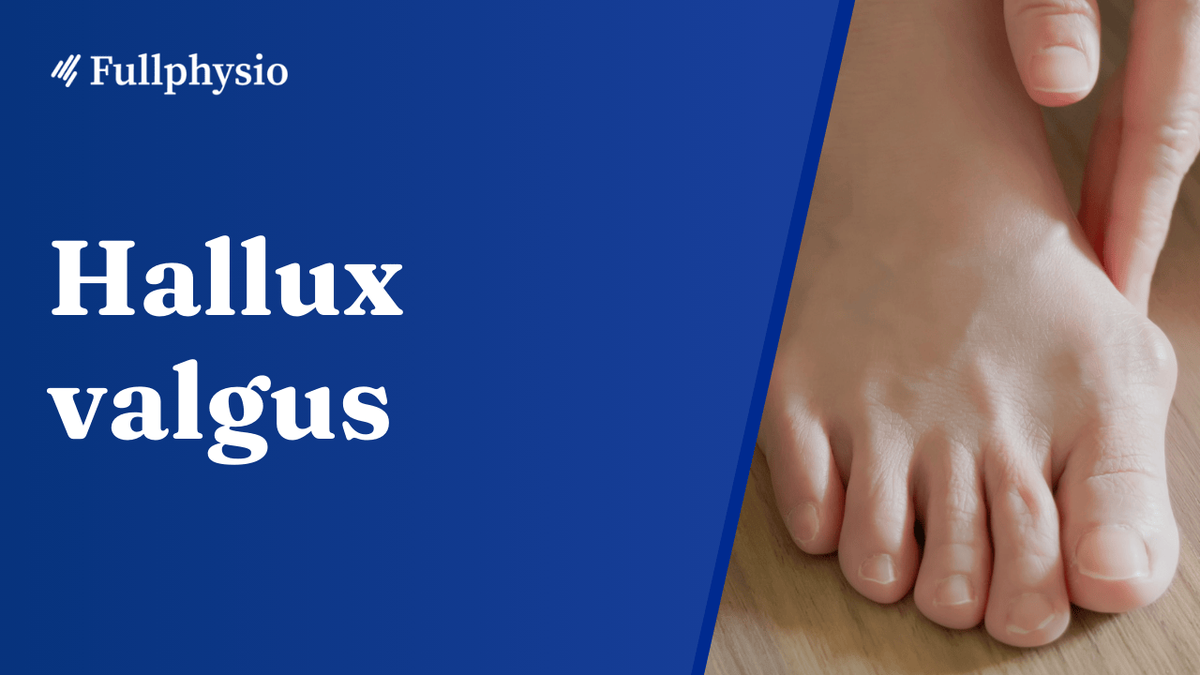Hallux valgus