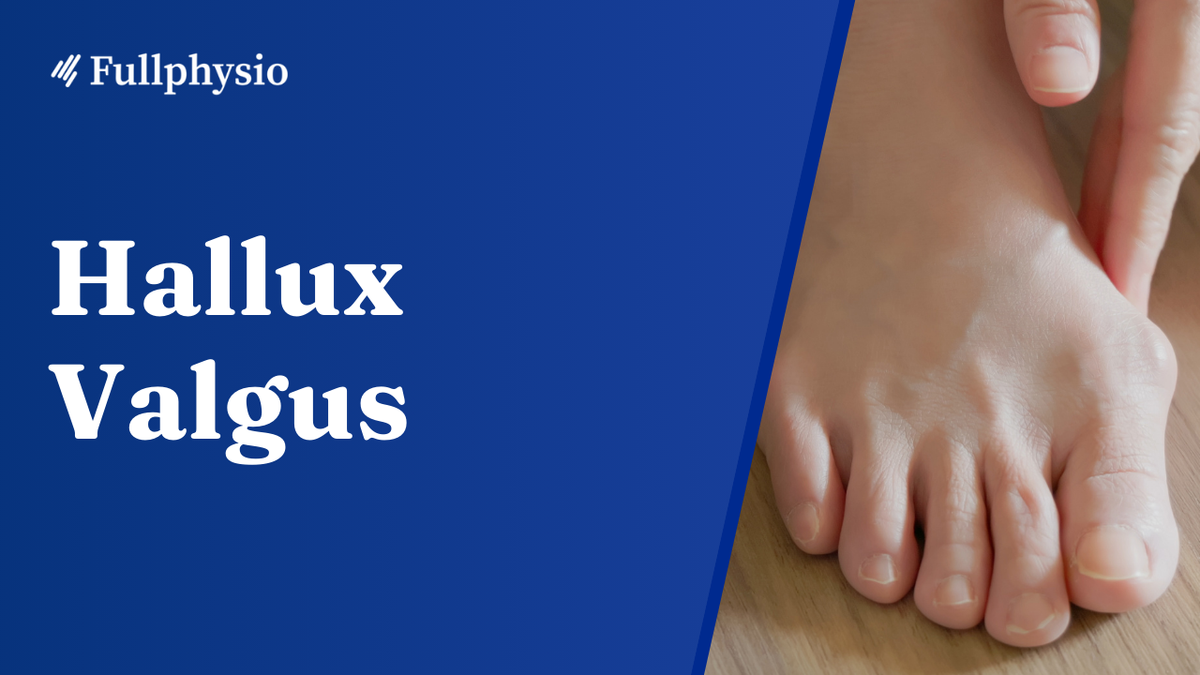Hallux Valgus