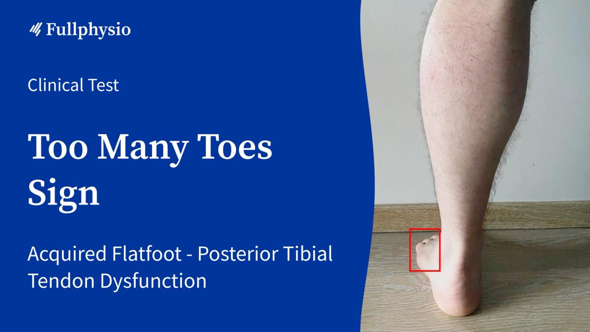 Too Many Toes Sign