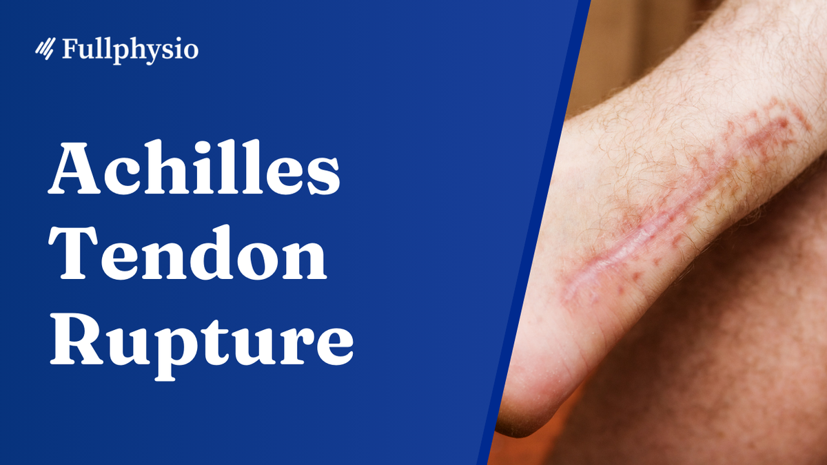 Achilles Tendon Rupture