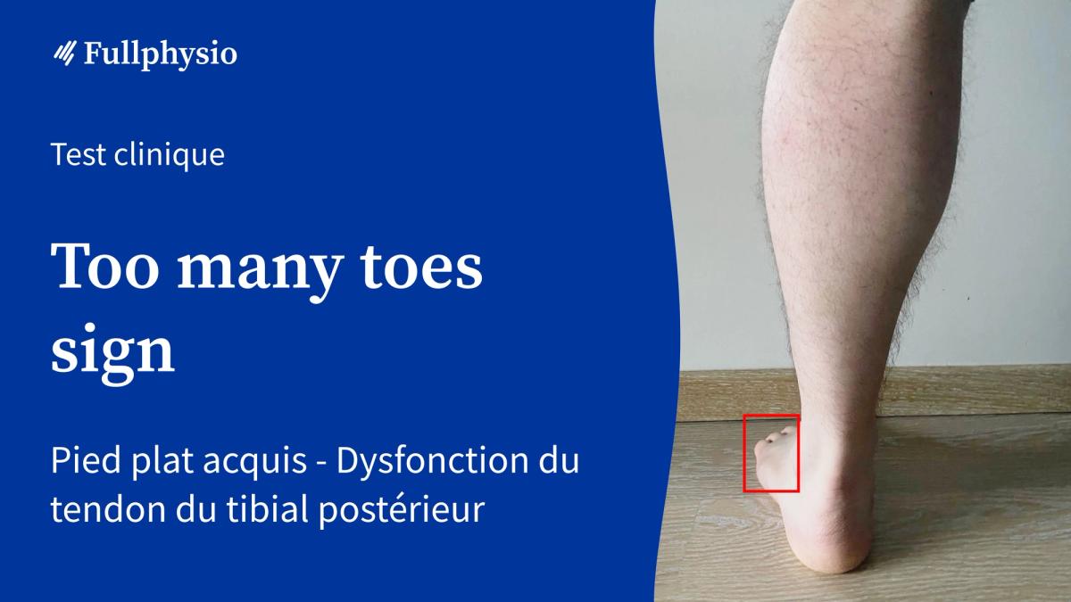 Too many toes sign