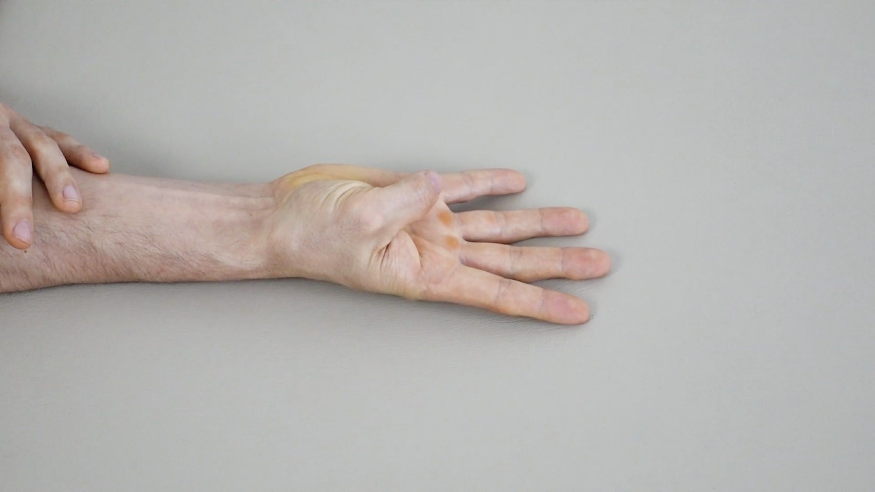 Thumb Flexion Mobilization, view 2