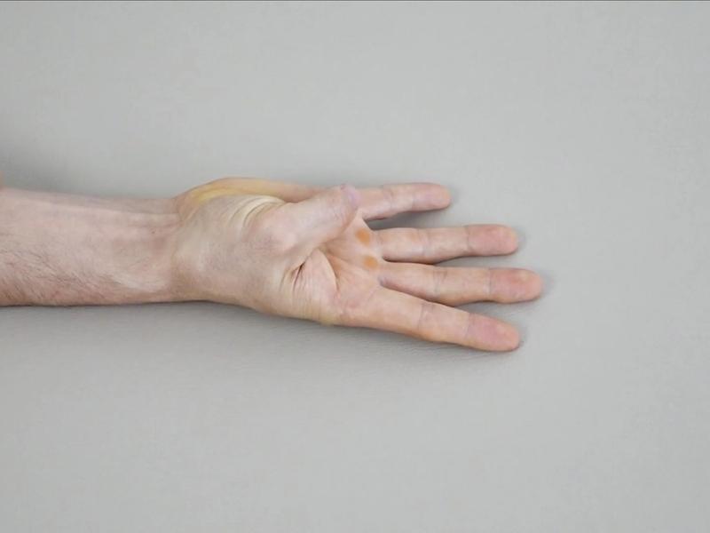 Thumb Flexion Mobilization, view 2