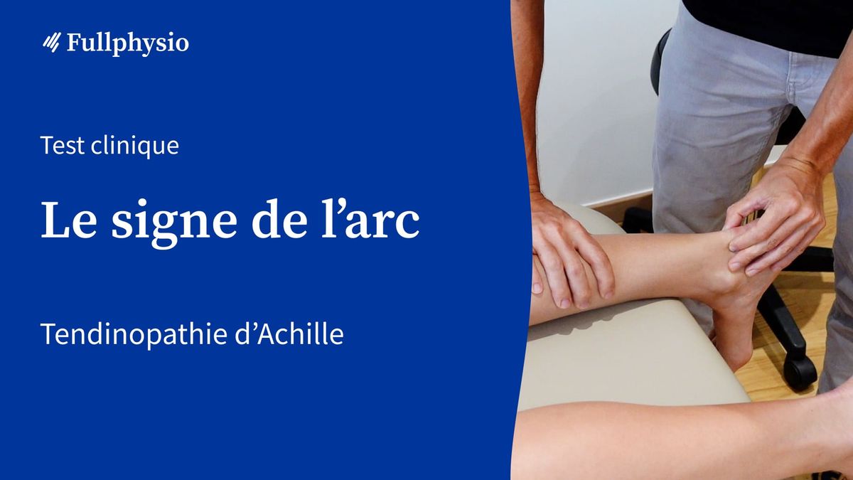 Signe de l'arc