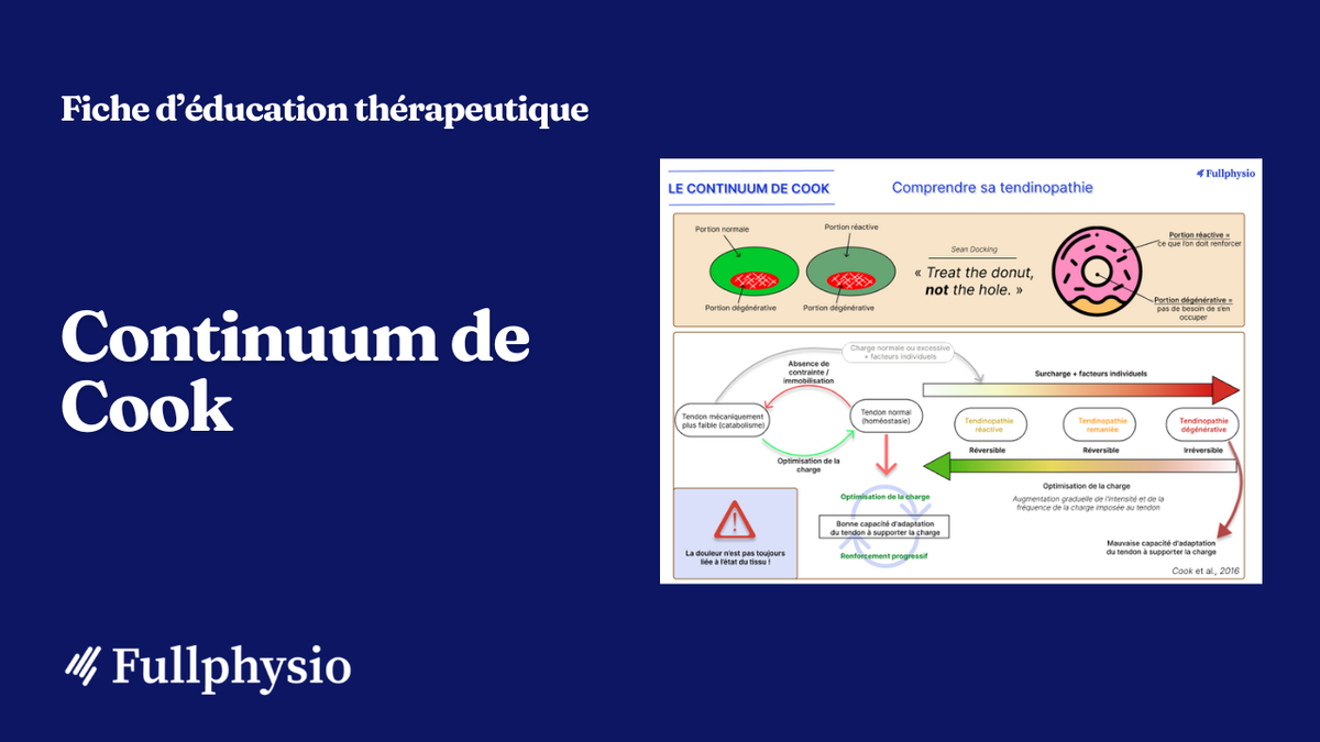 Comprendre sa tendinopathie (modèle de Cook)