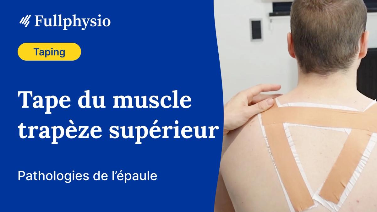 Tape du trapèze supérieur