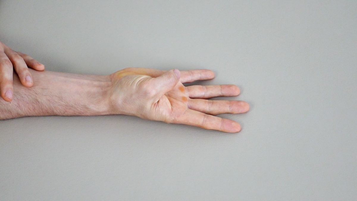 Thumb Flexion Mobilization