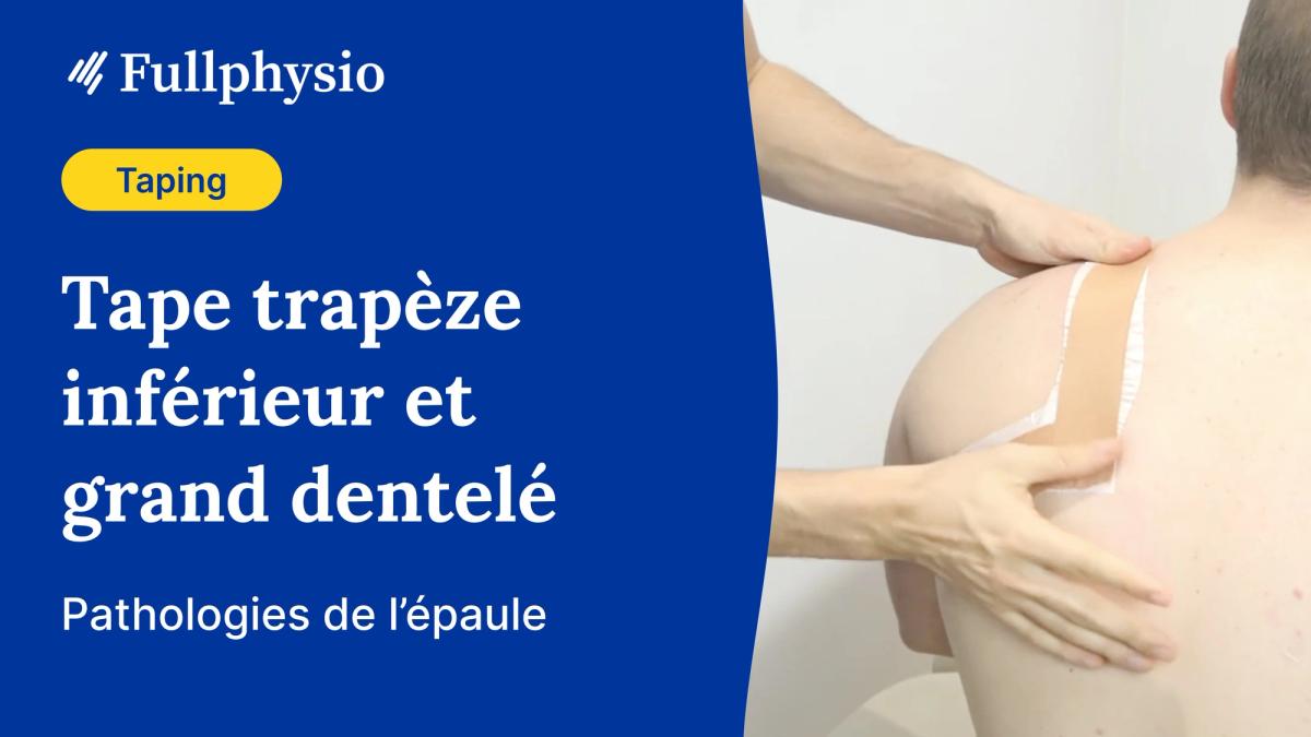 Tape trapèze inférieur et grand dentelé