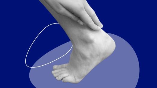 Tendon d'Achille