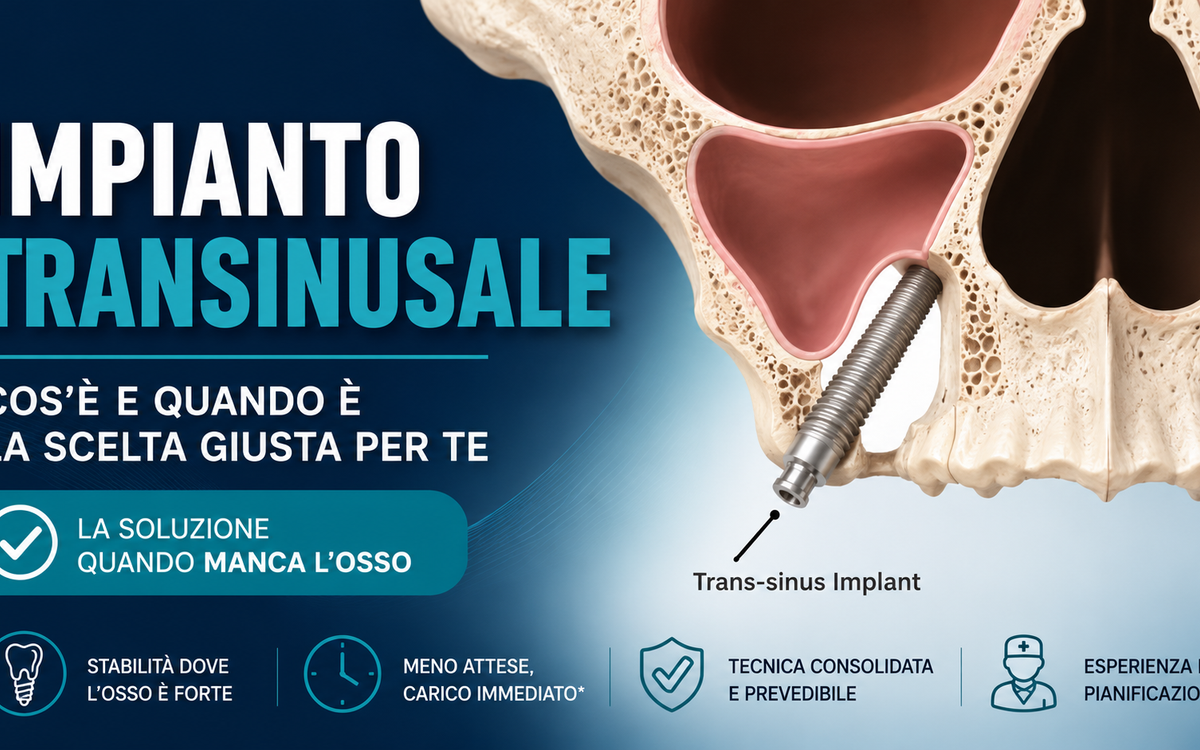 Impianto transinusale: cos'è e quando è la scelta giusta per te?