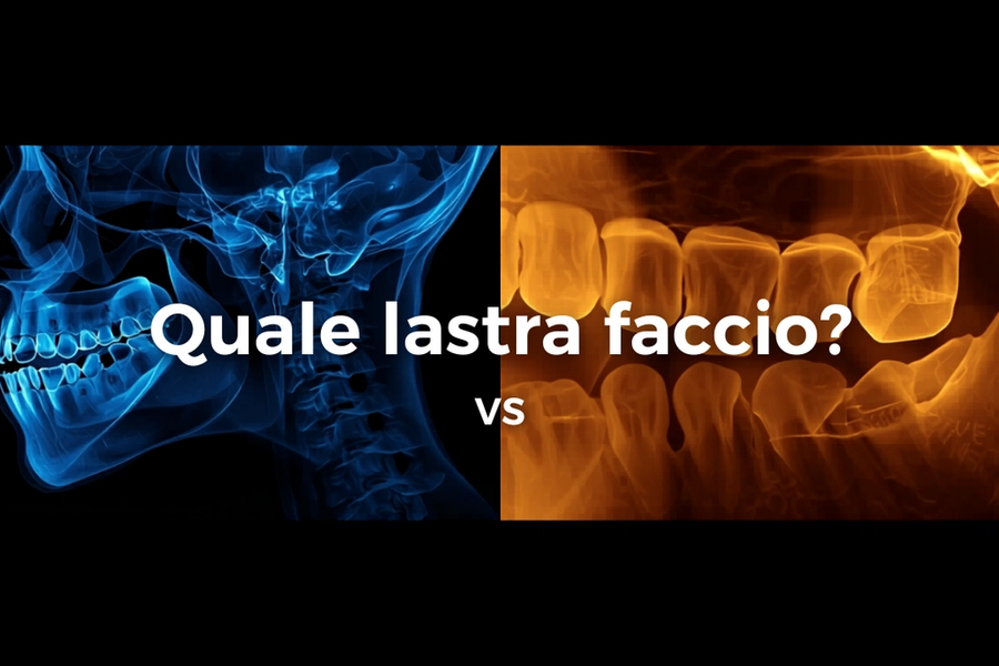 Panoramica, endorale o TAC: quale radiografia dentale serve davvero?
