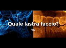 Panoramica, endorale o TAC: quale radiografia dentale serve davvero?