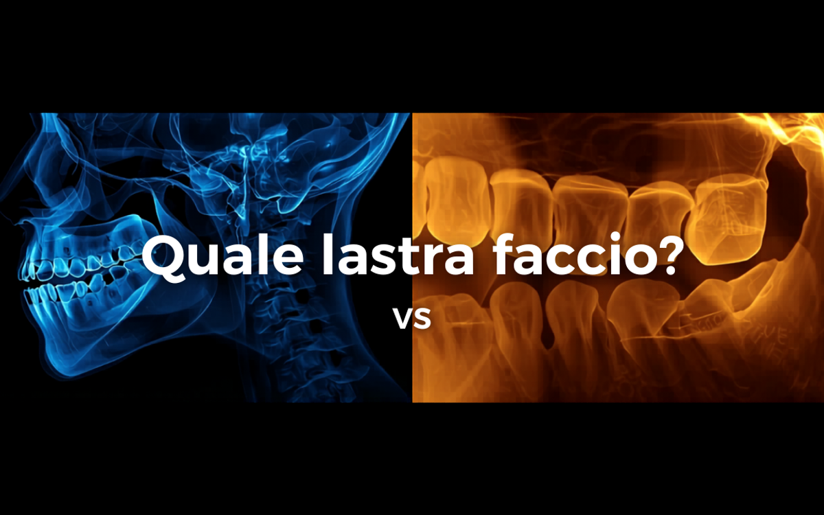 Panoramica, endorale o TAC: quale radiografia dentale serve davvero?