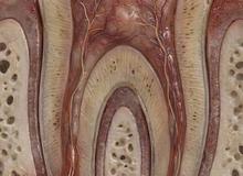 Dente devitalizzato: è davvero più fragile e va sempre incapsulato?