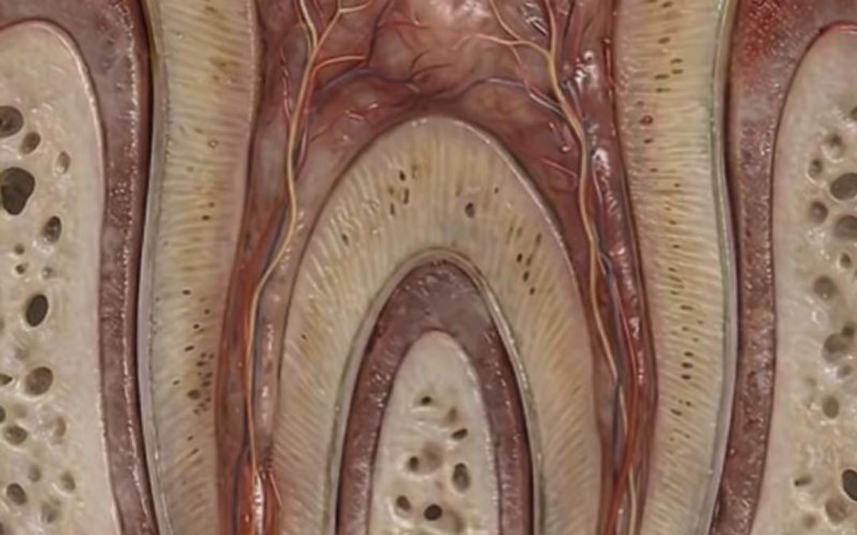 Dente devitalizzato: è davvero più fragile e va sempre incapsulato?