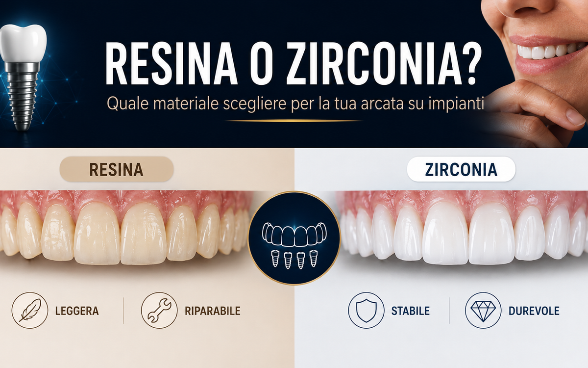 Zirconia o resina: di cosa sarà fatta la tua nuova arcata fissa su impianti?