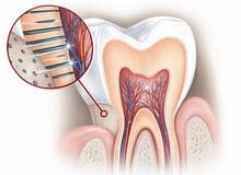 I dentifrici desensibilizzanti funzionano davvero o non servono a nulla?