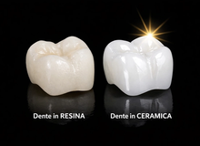 Denti in resina o in ceramica: qual è la vera differenza?