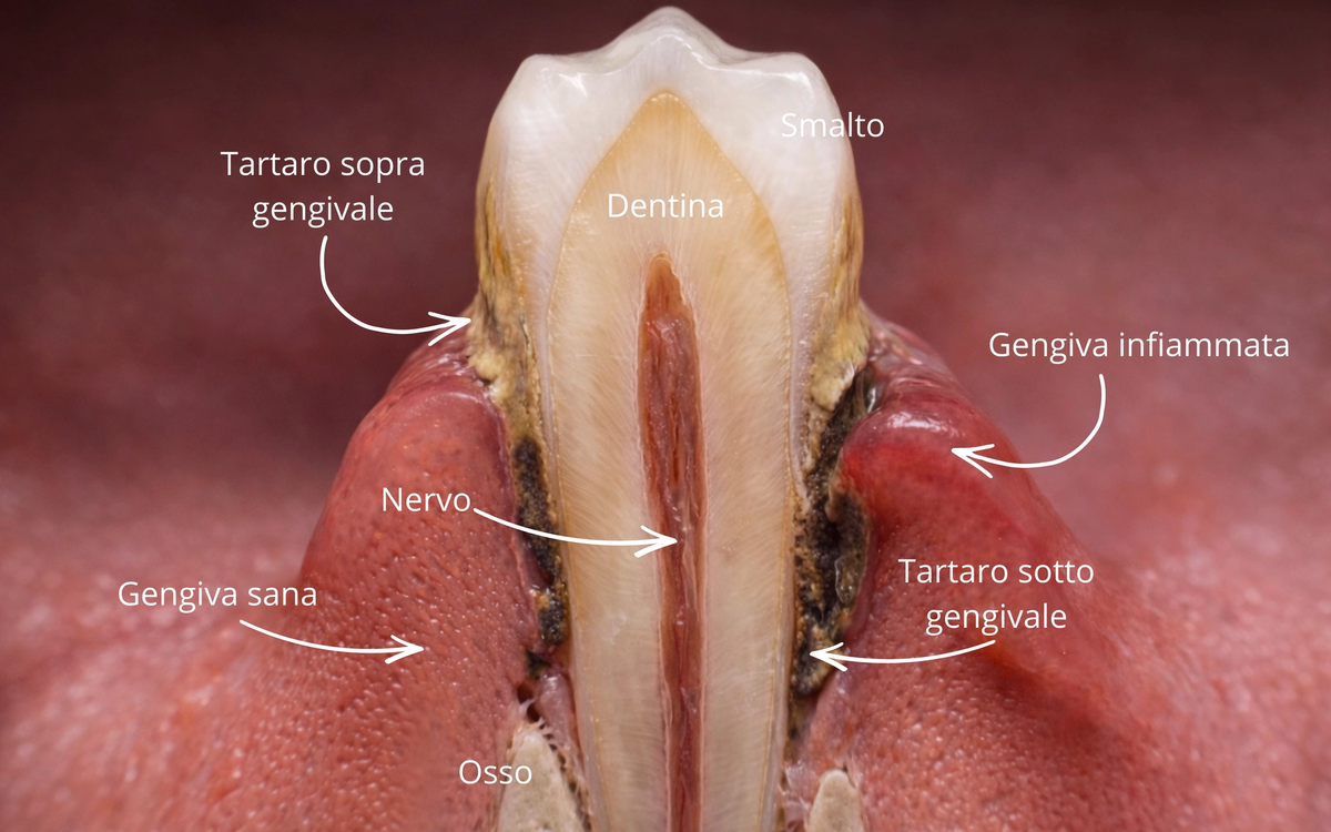 Parodontite: cos’è davvero e perché non puoi permetterti di ignorarla