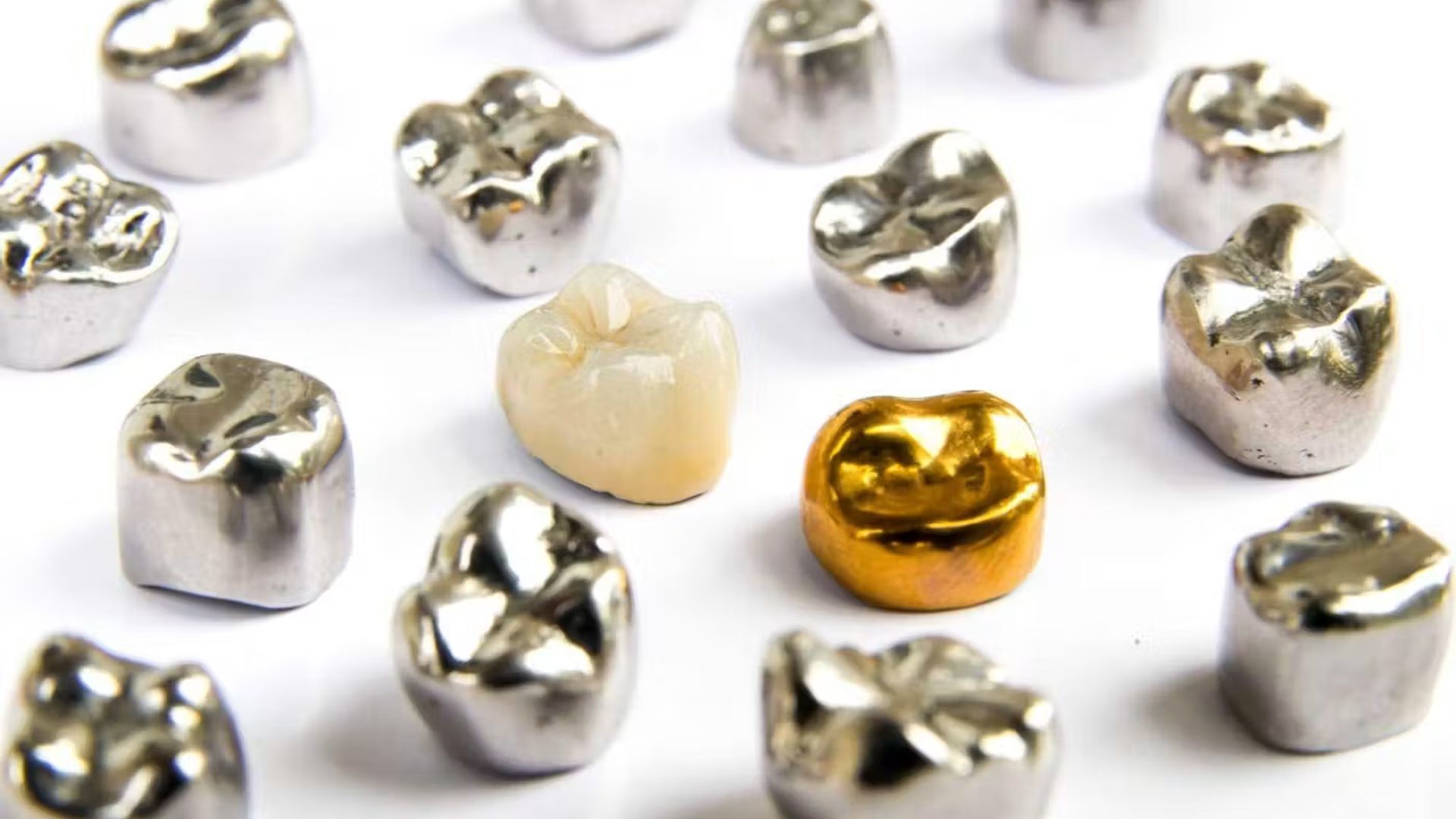Dental Crowns different materials