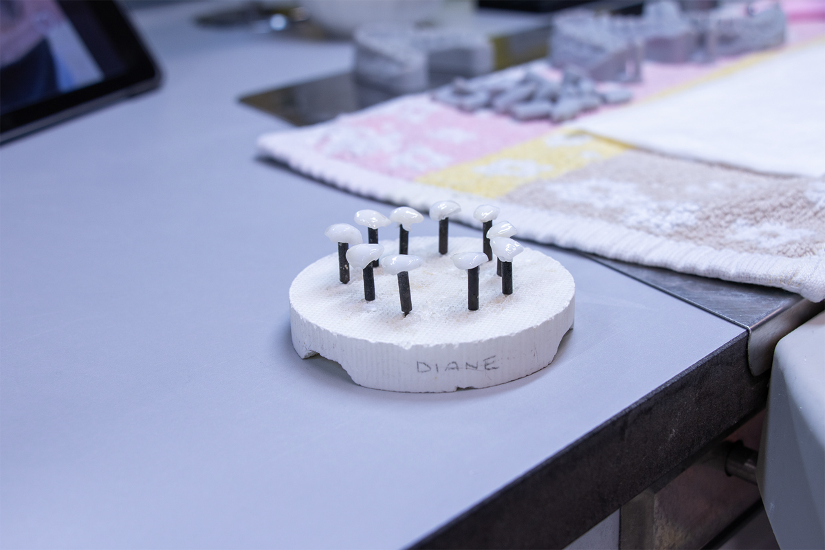 A white dental model showing multiple dark titanium or zirconia implant abutments arranged in a circular pattern, displayed on a laboratory workbench with shade guides and material samples.