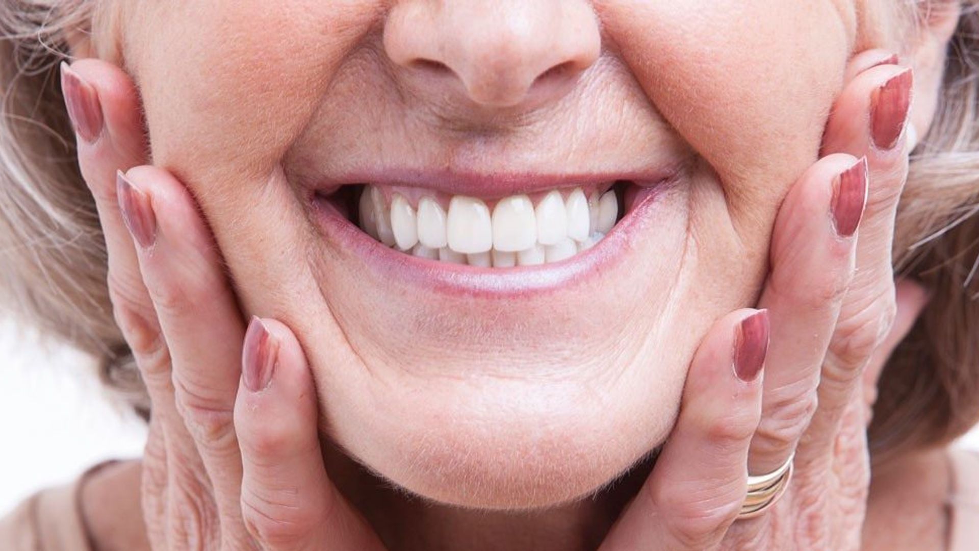 Dentures in Bicester