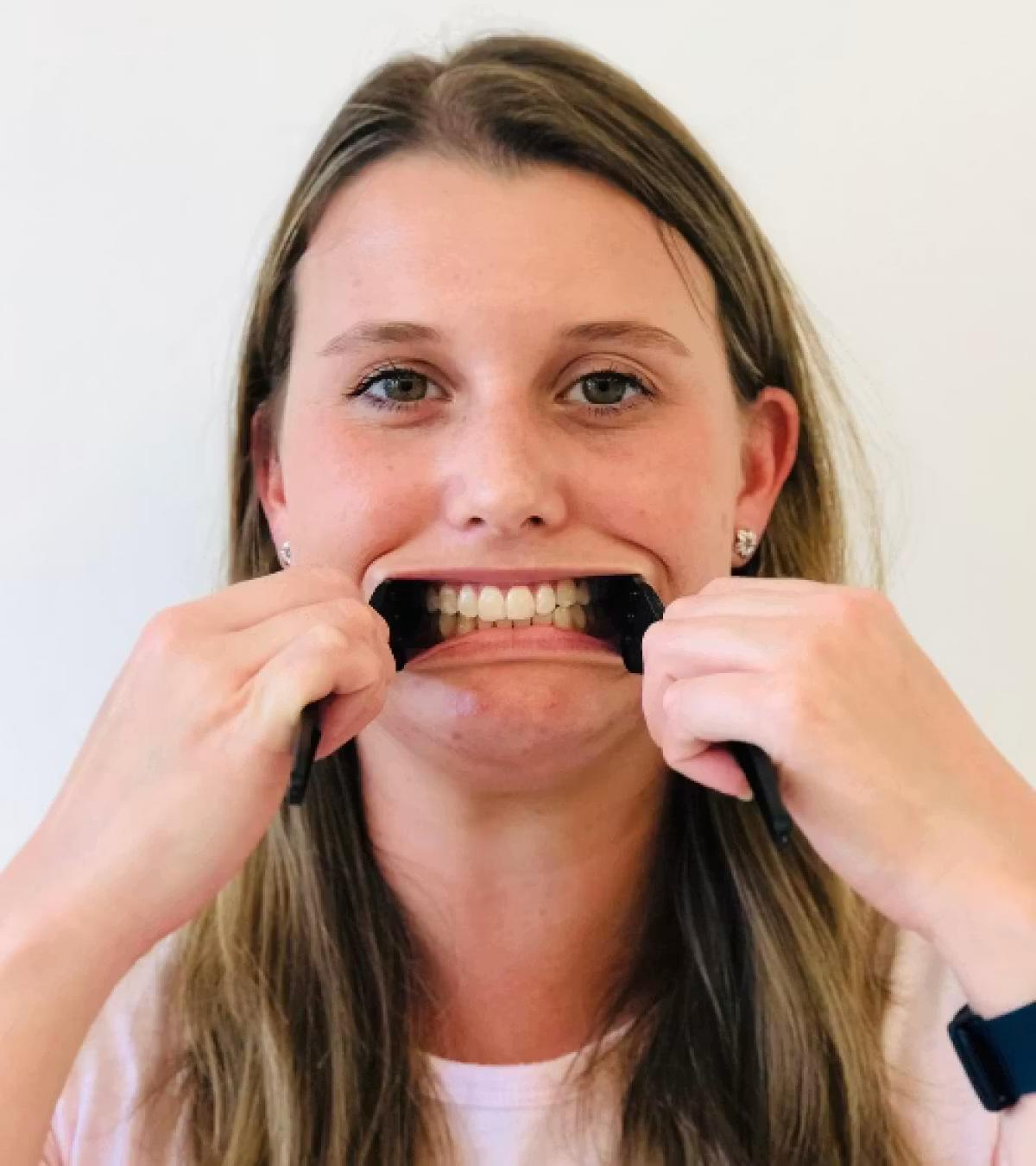 Image of a woman holding two spoons which are holding her cheeks on the right side and left of her face, showing her teeth