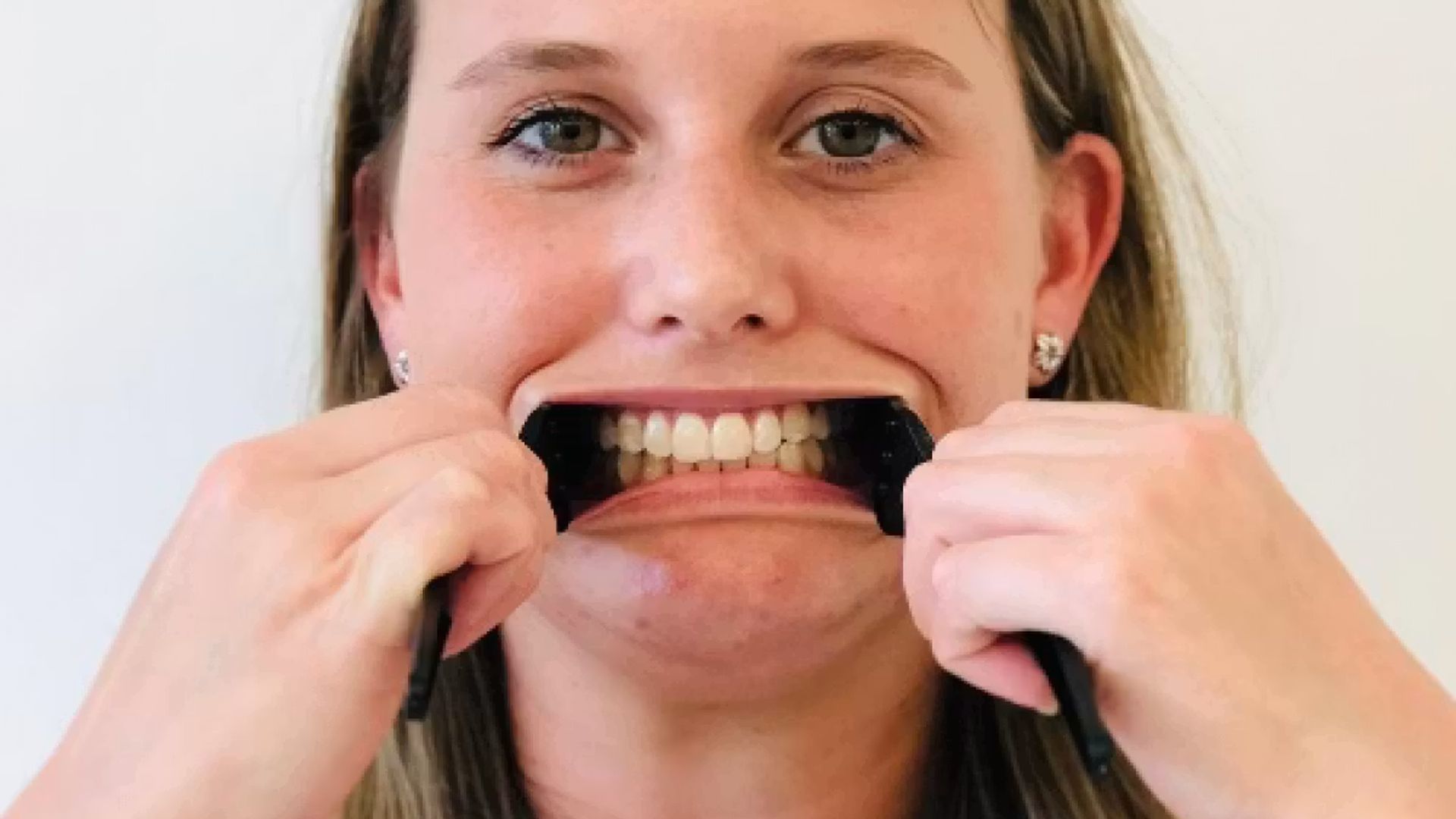 Image of a woman holding two spoons which are holding her cheeks on the right side and left of her face, showing her teeth
