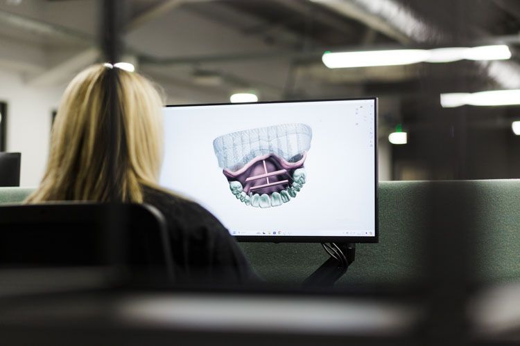 A person with blonde hair sits at a desk viewing a computer monitor that displays a 3D dental or orthodontic scan image in an office setting with fluorescent lighting.