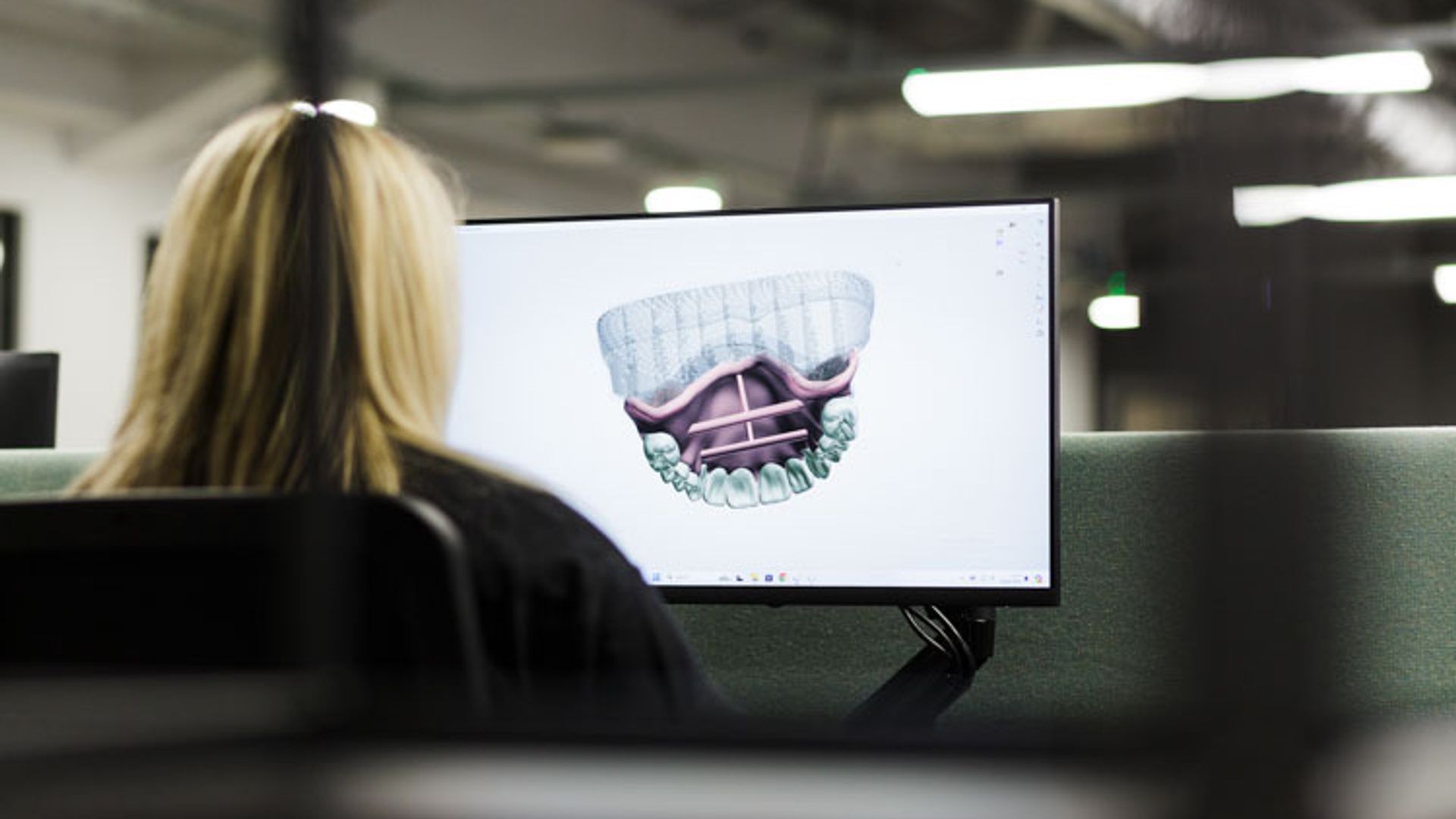 A person with blonde hair sits at a desk viewing a computer monitor that displays a 3D dental or orthodontic scan image in an office setting with fluorescent lighting.