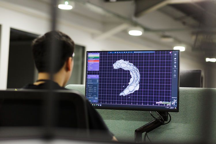 A person viewed from behind sits at a workstation viewing a computer monitor displaying a white 3D dental model on a blue grid interface in a modern office or laboratory setting.
