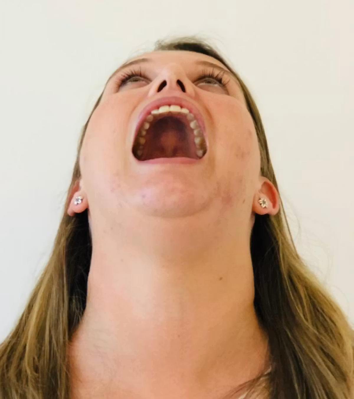 A woman with her mouth open and head tilted backwards, so her upper arch is visible