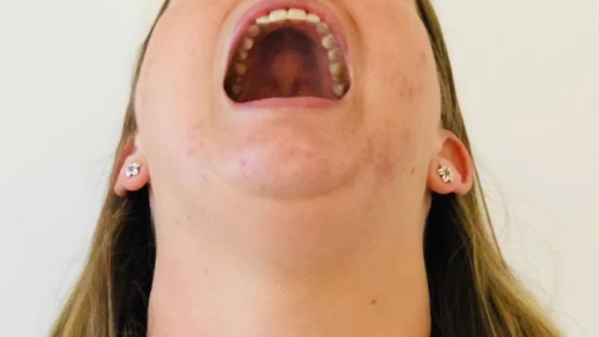 A woman with her mouth open and head tilted backwards, so her upper arch is visible