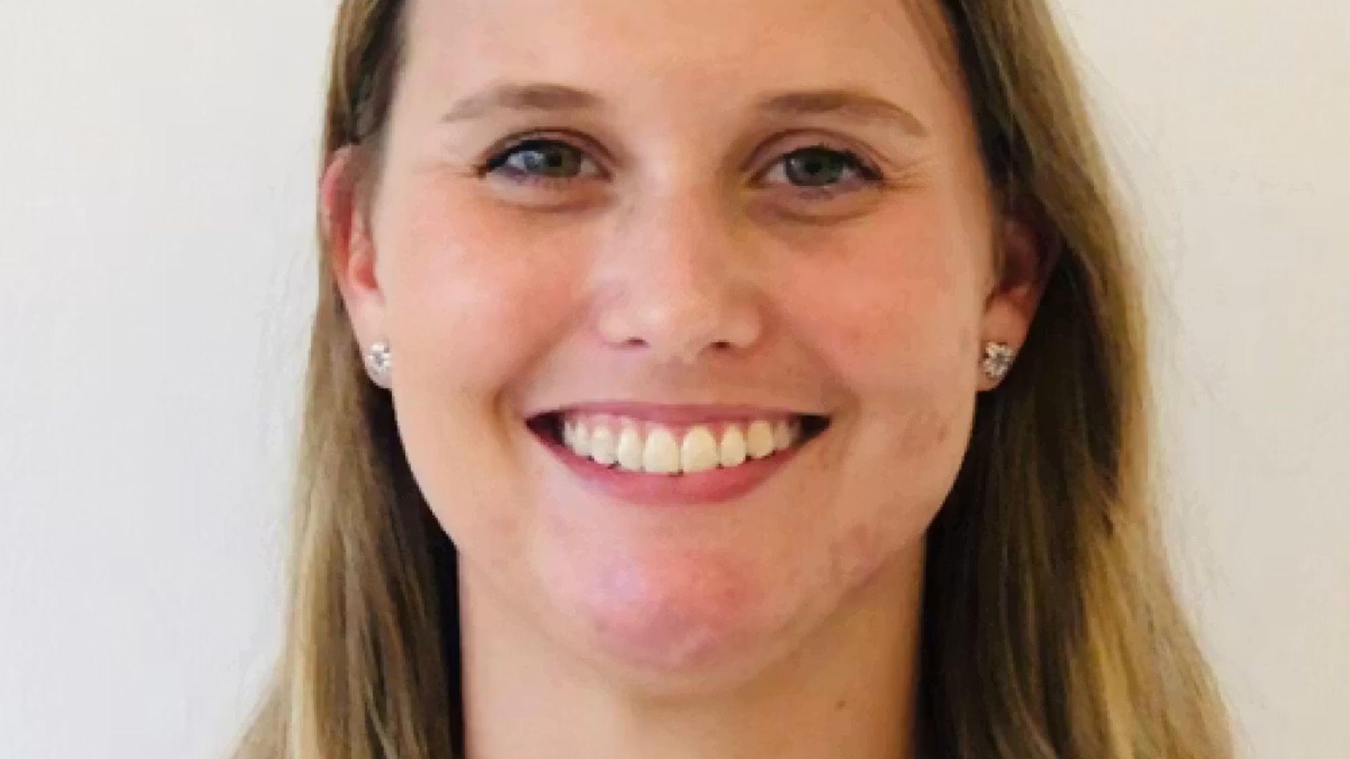 Image of a woman facing the camera and smiling with her teeth showing