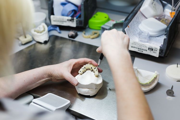 A technician's hands work on a dental prosthetic tooth model at a laboratory workstation, surrounded by 3D printing equipment, dental molds, and various tools and materials.