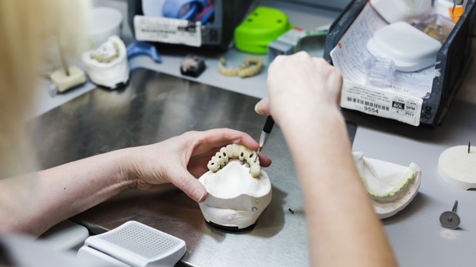 A technician's hands work on a dental prosthetic tooth model at a laboratory workstation, surrounded by 3D printing equipment, dental molds, and various tools and materials.