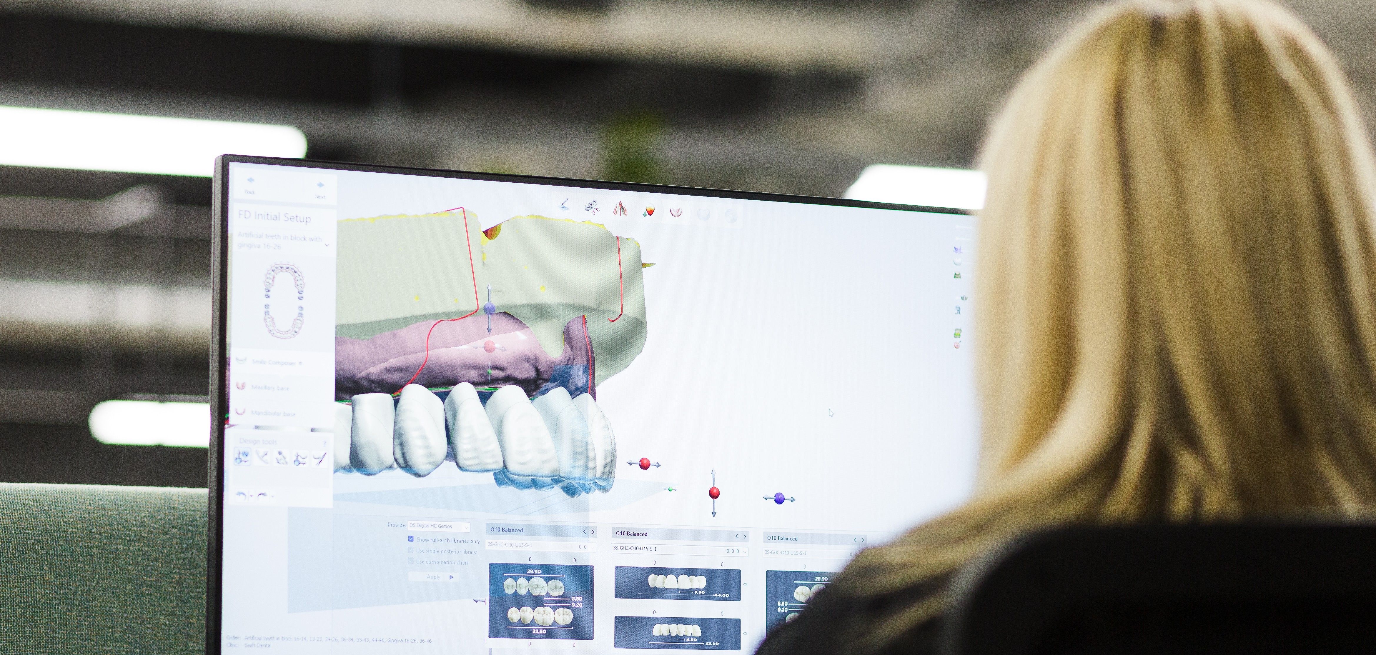 image of computer with dental implant software on it