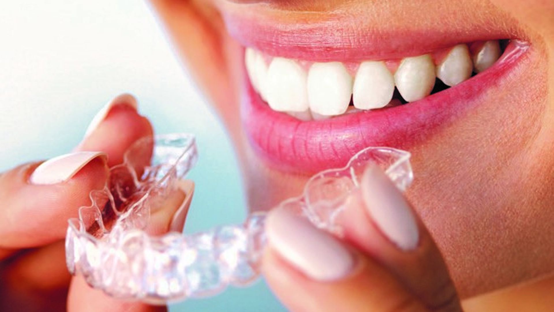 Take control of your smile with dental braces