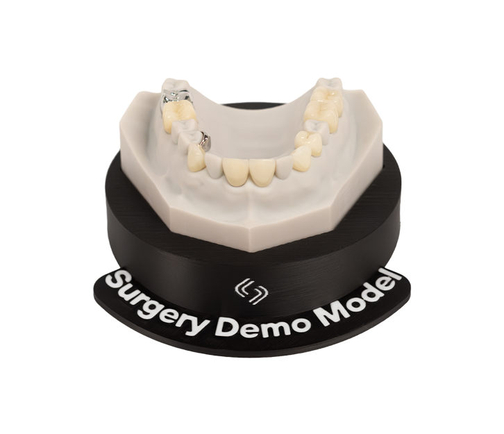 A dental surgery demonstration model showing a maxillary jaw with tooth-colored crowns and two implant abutments mounted on a black display base.