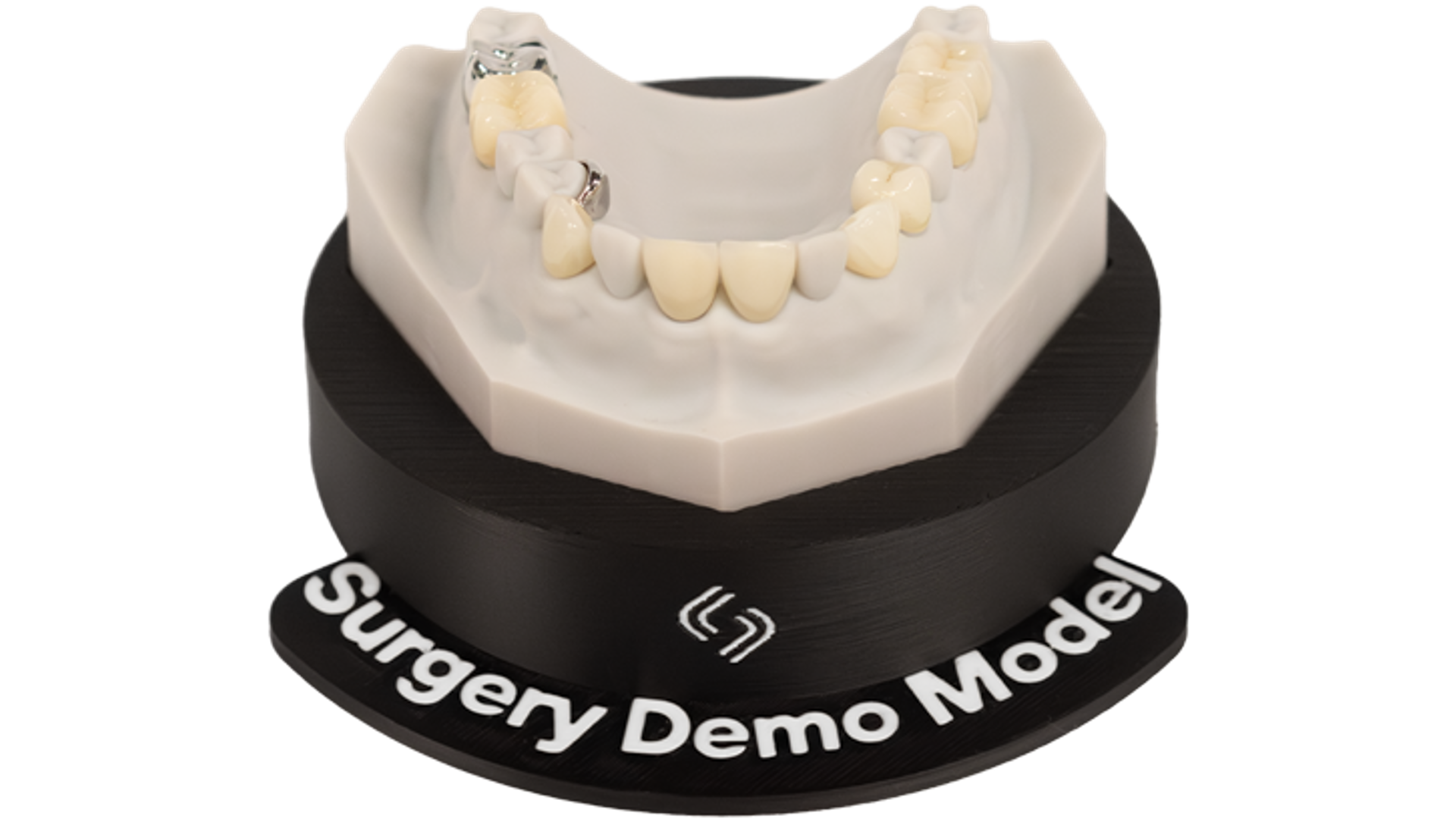 A dental surgery demonstration model showing a maxillary jaw with tooth-colored crowns and two implant abutments mounted on a black display base.
