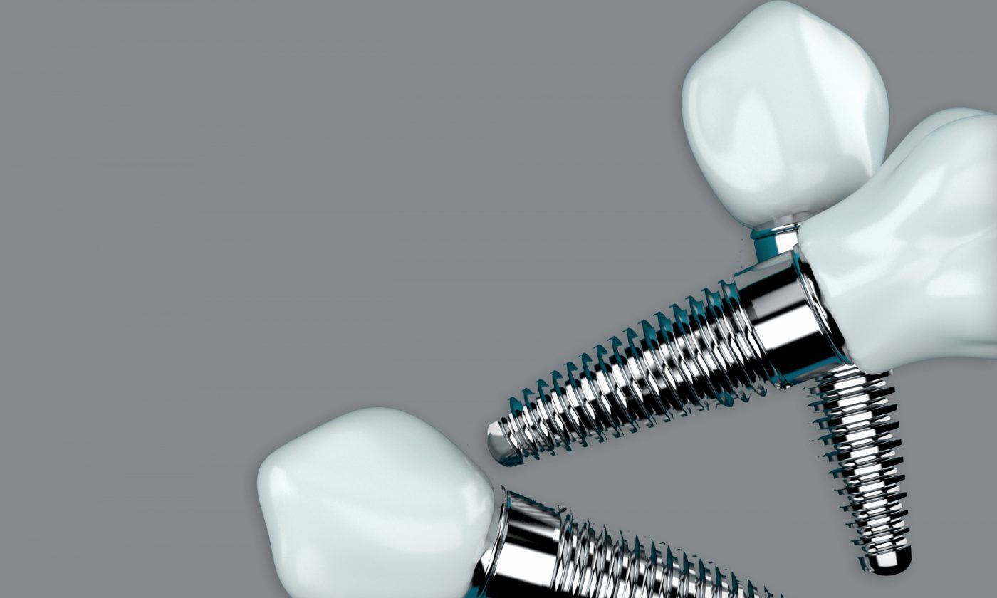 Dental implants treatment information in Cork