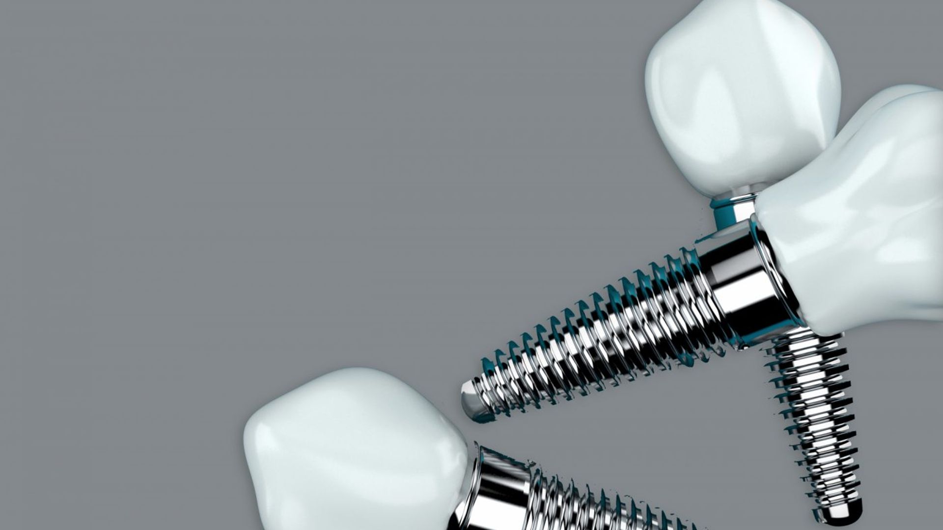 Dental implants treatment information in Cork